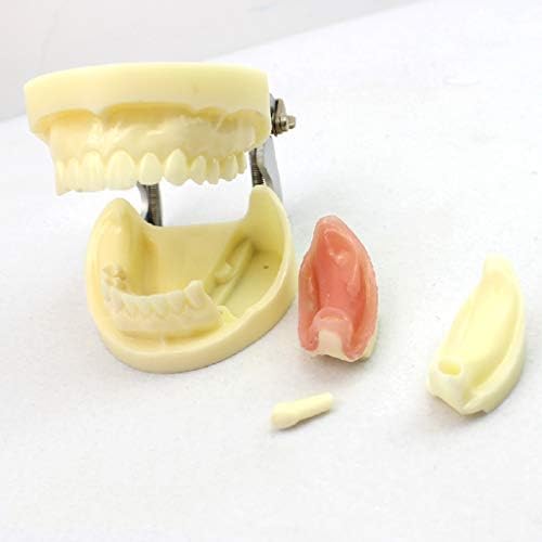 KH66ZKY Сменяеми Зъбни импланти Маркетингови Модели на зъбите на стандартния модел на Обучение на пациентите Инструмент