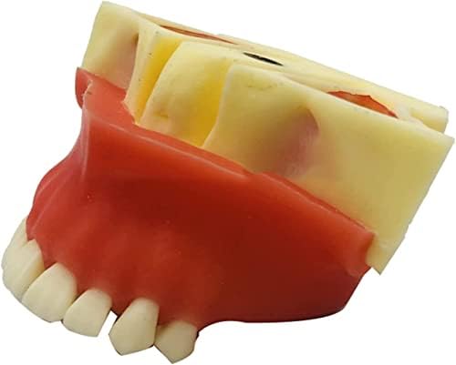 Модел на зъбите SHENGANG Зъбни Импланти, Модел Стягане на Максиларните синуси, Режим на практика Имплантиране на устната кухина, за обучение, Комуникация с пациентите,