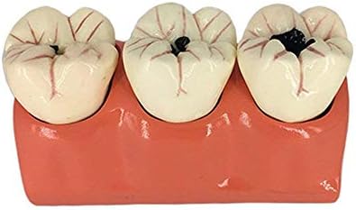 Образователна Модел, Анатомическая Модел, Стоматологичен Модел на Зъбите на Модел на Обучение на Пациента Модел Зъб за