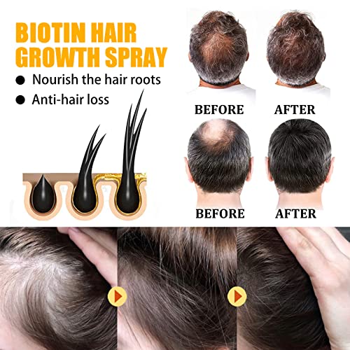 Стягащ биотиновый спрей за коса HairGenics - стимулира растежа на косата, възстановява ги от падане и укрепва корените