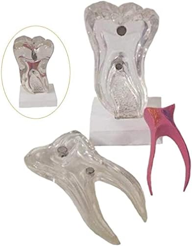 Образователна модел RRGJ, Анатомическая Модел на Зъбите - Стандартна Демонстрационен модел Патологични на зъбите, устната Кухина, за възрастни - Подвижен модел на зъ?
